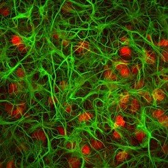 The biologic elements of synthetic neuronal circuits: Neurons (red) connected and linked in a dense network of Glia cells (green). Both cell types are <span>immunolabeled and </span>visible under the microscope.