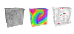 From ultrasound images (left), Max Planck researchers have reconstructed how the heart muscle contracts vortex-like (centre) in cardiac arrhythmia. This also allows the researchers to locate the filaments (right) that form the centre of the vortices. It is hoped that these insights will provide the basis for developing improved treatment methods.