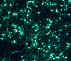 Zufällig geknüpft? Im Fluoreszenzmikroskop wird das weitgehend zufällige Netzwerk sichtbar, das Nervenzellen in einer Zellkultur bilden. Ob die Nervenzellen im Gehirn zufällig verschaltet werden, hat ein internationales Team um Forscher des Max-Planck-Instituts für Dynamik und Selbstorganisation untersucht.