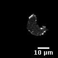 Figure 1:A confocal laser scanning image of Dictyostelium discoideum LimE-GFP: bright spots mark a high LimE-GFP concentration.