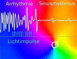 Eine ventrikuläre Herzrhythmusstörung kann durch eine Abfolge von Lichtimpulsen (blaue Linie) in einen normalen Sinusrhythmus (weiße Linie) umgewandelt werden, wie Versuche in optogenetischen Mausherzen zeigten. Durch die Anwendung dieses gepulsten Lichts werden die rotierenden Wellen (mehrfarbig im Hintergrund), die die Arrhythmie auslösen, effektiv beendet.